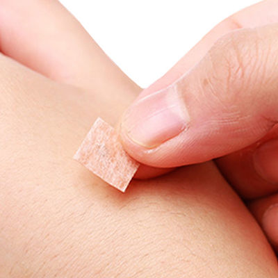 Agulhas de acupuntura com ponta afiada em aço inoxidável para desempenho preciso